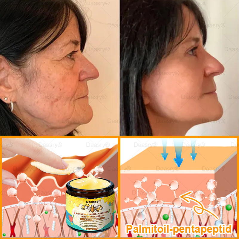 𝐃𝐚𝐚𝐬𝐫𝐲® 𝐌é𝐡𝐦é𝐫𝐞𝐠 𝐊𝐞𝐳𝐞𝐥ő 𝐊𝐫é𝐦, 𝐦é𝐡𝐦é𝐫𝐞𝐠 𝐩𝐞𝐩𝐭𝐢𝐝𝐞𝐤𝐤𝐞𝐥, 𝐛𝐨𝐭𝐮𝐥𝐢𝐧𝐮𝐦 𝐭𝐨𝐱𝐢𝐧𝐧𝐚𝐥, 𝐡𝐢𝐚𝐥𝐮𝐫𝐨𝐧𝐬𝐚𝐯𝐯𝐚𝐥 é𝐬 𝐤𝐨𝐥𝐥𝐚𝐠é𝐧𝐧𝐞𝐥💧. 𝐇𝐚𝐭é𝐤𝐨𝐧𝐲𝐚𝐧 𝐤ü𝐳𝐝 𝐚 𝐫á𝐧𝐜𝐨𝐤, 𝐟𝐢𝐧𝐨𝐦 𝐯𝐨𝐧𝐚𝐥𝐚𝐤, 𝐦𝐞𝐠𝐞𝐫𝐞𝐬𝐳𝐤𝐞𝐝é𝐬, 𝐭𝐞𝐫𝐡𝐞𝐬𝐬é𝐠𝐢 𝐜𝐬í𝐤𝐨𝐤 é𝐬 𝐬ö𝐭é𝐭 𝐟𝐨𝐥𝐭𝐨𝐤 𝐞𝐥𝐥𝐞𝐧 — 𝐟𝐞𝐬𝐳𝐞𝐬í𝐭é𝐬, 𝐞𝐦𝐞𝐥é𝐬 é𝐬 𝐤𝐢𝐞𝐦𝐞𝐥𝐤𝐞𝐝ő 𝐞𝐫𝐞𝐝𝐦é𝐧𝐲𝐞𝐤!