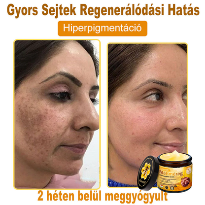🏆🐝 𝑿𝑰𝑴𝑶𝐍𝐓𝐇® 𝐌é𝐡𝐦é𝒓𝒆𝒈 𝑩ő𝒓𝒓𝒆𝒈𝐞𝐧𝐞𝐫á𝐥ó 𝐊𝐫é𝒎 🔥 Magyar fejlesztés, magyarországi gyártás és szállítás
