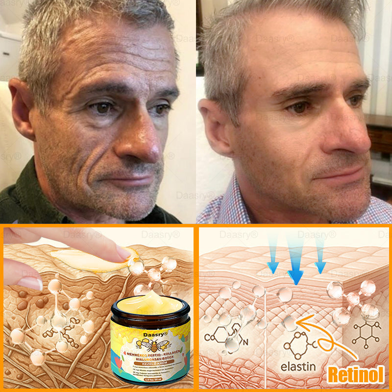 𝐃𝐚𝐚𝐬𝐫𝐲® 𝐌é𝐡𝐦é𝐫𝐞𝐠 𝐊𝐞𝐳𝐞𝐥ő 𝐊𝐫é𝐦, 𝐦é𝐡𝐦é𝐫𝐞𝐠 𝐩𝐞𝐩𝐭𝐢𝐝𝐞𝐤𝐤𝐞𝐥, 𝐛𝐨𝐭𝐮𝐥𝐢𝐧𝐮𝐦 𝐭𝐨𝐱𝐢𝐧𝐧𝐚𝐥, 𝐡𝐢𝐚𝐥𝐮𝐫𝐨𝐧𝐬𝐚𝐯𝐯𝐚𝐥 é𝐬 𝐤𝐨𝐥𝐥𝐚𝐠é𝐧𝐧𝐞𝐥💧. 𝐇𝐚𝐭é𝐤𝐨𝐧𝐲𝐚𝐧 𝐤ü𝐳𝐝 𝐚 𝐫á𝐧𝐜𝐨𝐤, 𝐟𝐢𝐧𝐨𝐦 𝐯𝐨𝐧𝐚𝐥𝐚𝐤, 𝐦𝐞𝐠𝐞𝐫𝐞𝐬𝐳𝐤𝐞𝐝é𝐬, 𝐭𝐞𝐫𝐡𝐞𝐬𝐬é𝐠𝐢 𝐜𝐬í𝐤𝐨𝐤 é𝐬 𝐬ö𝐭é𝐭 𝐟𝐨𝐥𝐭𝐨𝐤 𝐞𝐥𝐥𝐞𝐧 — 𝐟𝐞𝐬𝐳𝐞𝐬í𝐭é𝐬, 𝐞𝐦𝐞𝐥é𝐬 é𝐬 𝐤𝐢𝐞𝐦𝐞𝐥𝐤𝐞𝐝ő 𝐞𝐫𝐞𝐝𝐦é𝐧𝐲𝐞𝐤!