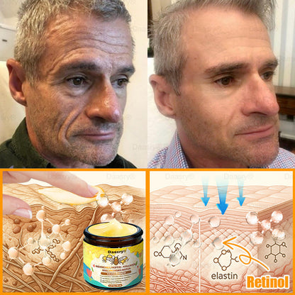 𝐃𝐚𝐚𝐬𝐫𝐲® 𝐌é𝐡𝐦é𝐫𝐞𝐠 𝐊𝐞𝐳𝐞𝐥ő 𝐊𝐫é𝐦, 𝐦é𝐡𝐦é𝐫𝐞𝐠 𝐩𝐞𝐩𝐭𝐢𝐝𝐞𝐤𝐤𝐞𝐥, 𝐛𝐨𝐭𝐮𝐥𝐢𝐧𝐮𝐦 𝐭𝐨𝐱𝐢𝐧𝐧𝐚𝐥, 𝐡𝐢𝐚𝐥𝐮𝐫𝐨𝐧𝐬𝐚𝐯𝐯𝐚𝐥 é𝐬 𝐤𝐨𝐥𝐥𝐚𝐠é𝐧𝐧𝐞𝐥💧. 𝐇𝐚𝐭é𝐤𝐨𝐧𝐲𝐚𝐧 𝐤ü𝐳𝐝 𝐚 𝐫á𝐧𝐜𝐨𝐤, 𝐟𝐢𝐧𝐨𝐦 𝐯𝐨𝐧𝐚𝐥𝐚𝐤, 𝐦𝐞𝐠𝐞𝐫𝐞𝐬𝐳𝐤𝐞𝐝é𝐬, 𝐭𝐞𝐫𝐡𝐞𝐬𝐬é𝐠𝐢 𝐜𝐬í𝐤𝐨𝐤 é𝐬 𝐬ö𝐭é𝐭 𝐟𝐨𝐥𝐭𝐨𝐤 𝐞𝐥𝐥𝐞𝐧 — 𝐟𝐞𝐬𝐳𝐞𝐬í𝐭é𝐬, 𝐞𝐦𝐞𝐥é𝐬 é𝐬 𝐤𝐢𝐞𝐦𝐞𝐥𝐤𝐞𝐝ő 𝐞𝐫𝐞𝐝𝐦é𝐧𝐲𝐞𝐤!