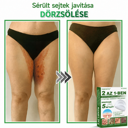 👉𝐗𝐈𝐌𝐎𝐍𝐓𝐇® 𝟐-𝐚𝐳-𝟏-𝐛𝐞𝐧 𝐌𝐢𝐤𝐫𝐨𝐭ű & 𝐇𝐢𝐝𝐫𝐨𝐤𝐨𝐥𝐨𝐢𝐝 𝐓𝐚𝐩𝐚𝐬𝐳 🇭🇺|👩🧒Kiemelkedő Anyajegyek, Pattanások, Lapos Szemölcsök & Bőrkinövések Eltávolítója | Ráncok, Hegek & Bőrhibák Javítása | Láthatatlan Csillag Pattanástapasz Arcra & Testre | 144 db