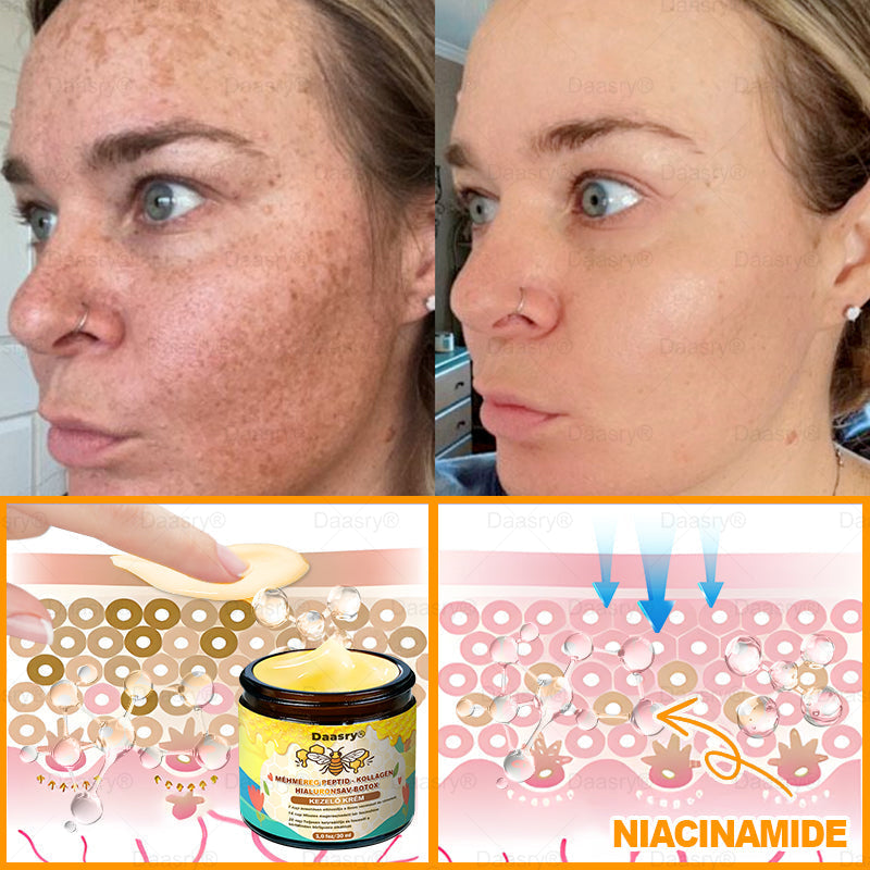 𝐃𝐚𝐚𝐬𝐫𝐲® 𝐌é𝐡𝐦é𝐫𝐞𝐠 𝐊𝐞𝐳𝐞𝐥ő 𝐊𝐫é𝐦, 𝐦é𝐡𝐦é𝐫𝐞𝐠 𝐩𝐞𝐩𝐭𝐢𝐝𝐞𝐤𝐤𝐞𝐥, 𝐛𝐨𝐭𝐮𝐥𝐢𝐧𝐮𝐦 𝐭𝐨𝐱𝐢𝐧𝐧𝐚𝐥, 𝐡𝐢𝐚𝐥𝐮𝐫𝐨𝐧𝐬𝐚𝐯𝐯𝐚𝐥 é𝐬 𝐤𝐨𝐥𝐥𝐚𝐠é𝐧𝐧𝐞𝐥💧. 𝐇𝐚𝐭é𝐤𝐨𝐧𝐲𝐚𝐧 𝐤ü𝐳𝐝 𝐚 𝐫á𝐧𝐜𝐨𝐤, 𝐟𝐢𝐧𝐨𝐦 𝐯𝐨𝐧𝐚𝐥𝐚𝐤, 𝐦𝐞𝐠𝐞𝐫𝐞𝐬𝐳𝐤𝐞𝐝é𝐬, 𝐭𝐞𝐫𝐡𝐞𝐬𝐬é𝐠𝐢 𝐜𝐬í𝐤𝐨𝐤 é𝐬 𝐬ö𝐭é𝐭 𝐟𝐨𝐥𝐭𝐨𝐤 𝐞𝐥𝐥𝐞𝐧 — 𝐟𝐞𝐬𝐳𝐞𝐬í𝐭é𝐬, 𝐞𝐦𝐞𝐥é𝐬 é𝐬 𝐤𝐢𝐞𝐦𝐞𝐥𝐤𝐞𝐝ő 𝐞𝐫𝐞𝐝𝐦é𝐧𝐲𝐞𝐤!