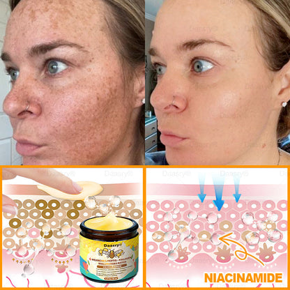 𝐃𝐚𝐚𝐬𝐫𝐲® 𝐌é𝐡𝐦é𝐫𝐞𝐠 𝐊𝐞𝐳𝐞𝐥ő 𝐊𝐫é𝐦, 𝐦é𝐡𝐦é𝐫𝐞𝐠 𝐩𝐞𝐩𝐭𝐢𝐝𝐞𝐤𝐤𝐞𝐥, 𝐛𝐨𝐭𝐮𝐥𝐢𝐧𝐮𝐦 𝐭𝐨𝐱𝐢𝐧𝐧𝐚𝐥, 𝐡𝐢𝐚𝐥𝐮𝐫𝐨𝐧𝐬𝐚𝐯𝐯𝐚𝐥 é𝐬 𝐤𝐨𝐥𝐥𝐚𝐠é𝐧𝐧𝐞𝐥💧. 𝐇𝐚𝐭é𝐤𝐨𝐧𝐲𝐚𝐧 𝐤ü𝐳𝐝 𝐚 𝐫á𝐧𝐜𝐨𝐤, 𝐟𝐢𝐧𝐨𝐦 𝐯𝐨𝐧𝐚𝐥𝐚𝐤, 𝐦𝐞𝐠𝐞𝐫𝐞𝐬𝐳𝐤𝐞𝐝é𝐬, 𝐭𝐞𝐫𝐡𝐞𝐬𝐬é𝐠𝐢 𝐜𝐬í𝐤𝐨𝐤 é𝐬 𝐬ö𝐭é𝐭 𝐟𝐨𝐥𝐭𝐨𝐤 𝐞𝐥𝐥𝐞𝐧 — 𝐟𝐞𝐬𝐳𝐞𝐬í𝐭é𝐬, 𝐞𝐦𝐞𝐥é𝐬 é𝐬 𝐤𝐢𝐞𝐦𝐞𝐥𝐤𝐞𝐝ő 𝐞𝐫𝐞𝐝𝐦é𝐧𝐲𝐞𝐤!