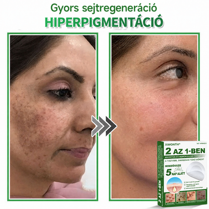 👉𝐗𝐈𝐌𝐎𝐍𝐓𝐇® 𝟐-𝐚𝐳-𝟏-𝐛𝐞𝐧 𝐌𝐢𝐤𝐫𝐨𝐭ű & 𝐇𝐢𝐝𝐫𝐨𝐤𝐨𝐥𝐨𝐢𝐝 𝐓𝐚𝐩𝐚𝐬𝐳 🇭🇺|👩🧒Kiemelkedő Anyajegyek, Pattanások, Lapos Szemölcsök & Bőrkinövések Eltávolítója | Ráncok, Hegek & Bőrhibák Javítása | Láthatatlan Csillag Pattanástapasz Arcra & Testre | 144 db