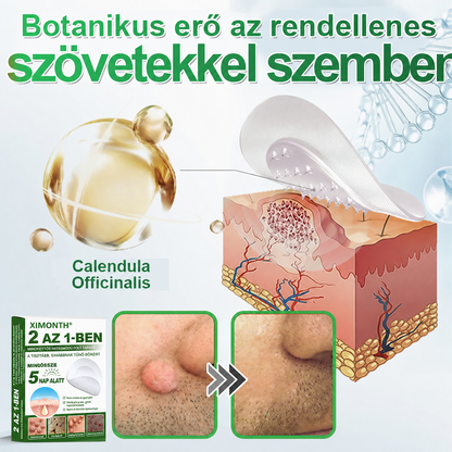 👉𝐗𝐈𝐌𝐎𝐍𝐓𝐇® 𝟐-𝐚𝐳-𝟏-𝐛𝐞𝐧 𝐌𝐢𝐤𝐫𝐨𝐭ű & 𝐇𝐢𝐝𝐫𝐨𝐤𝐨𝐥𝐨𝐢𝐝 𝐓𝐚𝐩𝐚𝐬𝐳 🇭🇺|👩🧒Kiemelkedő Anyajegyek, Pattanások, Lapos Szemölcsök & Bőrkinövések Eltávolítója | Ráncok, Hegek & Bőrhibák Javítása | Láthatatlan Csillag Pattanástapasz Arcra & Testre | 144 db
