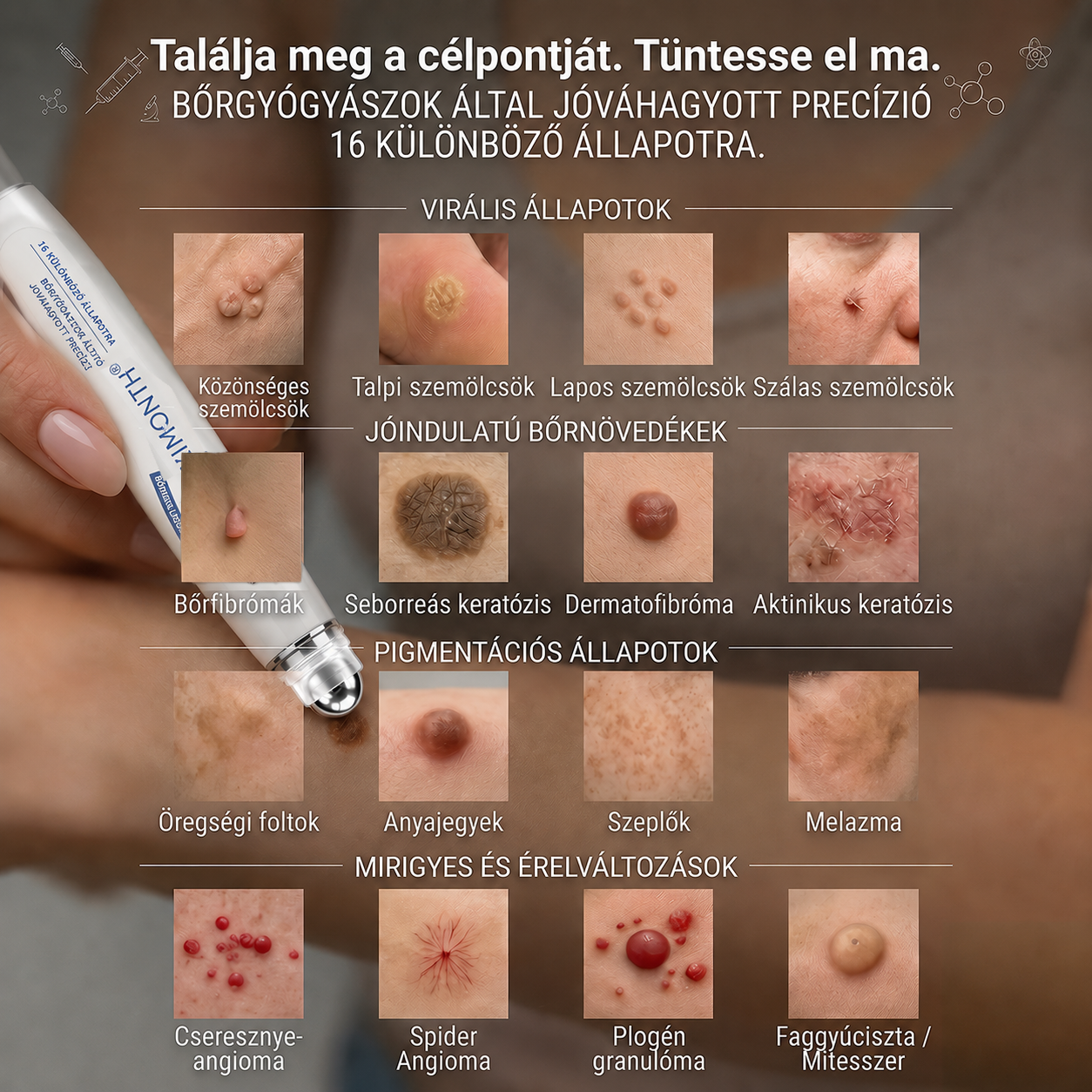 Hivatalos Márkabolt | 🚢🚢 𝐗𝐈𝐌𝐎𝐍𝐓𝐇® 7 napos Szemölcseltávolító Roll-on Ápoló Folyadék (Fájdalommentes rollerball technológia, hegek nélkül) 🐬
