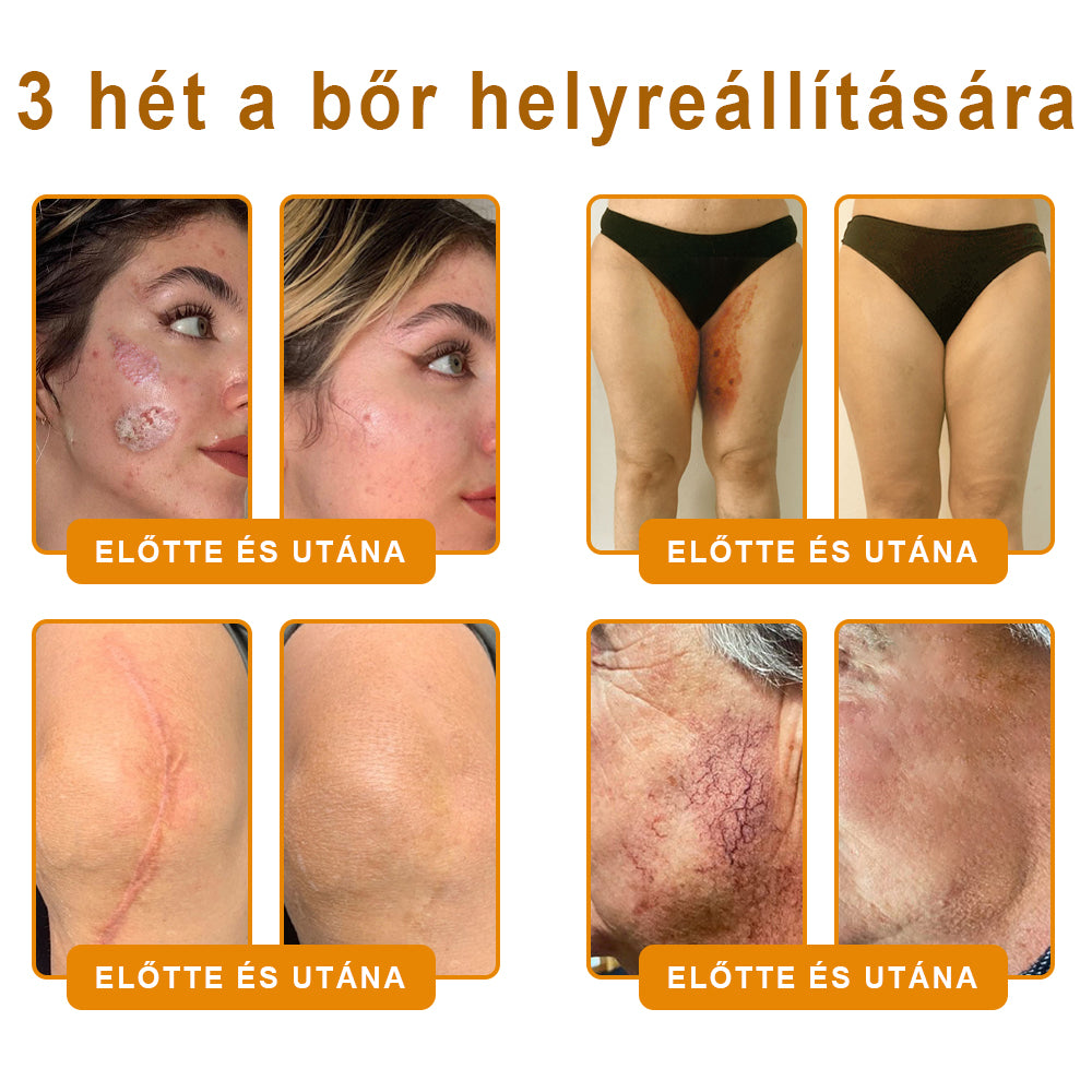 💟🏡✨ Magyarországon készült és innen szállítjuk 🌟  𝐕𝐋𝐒𝑉𝐿𝑆® Méh𝐦é𝐫𝐞𝐠 Bőrhely𝐫𝐞á𝐥𝐥í𝐭ó Krém 🔥 UTOLSÓ NAP – 80% KEDVEZMÉNY