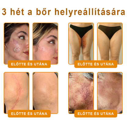 💟🏡✨ Magyarországon készült és innen szállítjuk 🌟  𝐕𝐋𝐒𝑉𝐿𝑆® Méh𝐦é𝐫𝐞𝐠 Bőrhely𝐫𝐞á𝐥𝐥í𝐭ó Krém 🔥 UTOLSÓ NAP – 80% KEDVEZMÉNY