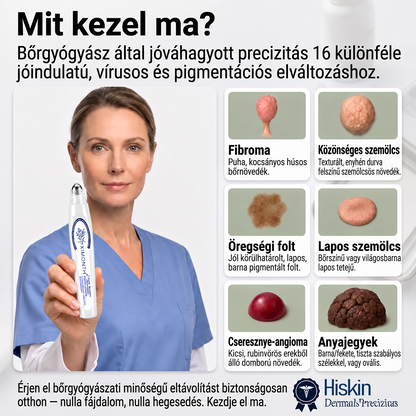 Hivatalos Márkabolt | 🚢🚢 𝐗𝐈𝐌𝐎𝐍𝐓𝐇® 7 napos Szemölcseltávolító Roll-on Ápoló Folyadék (Fájdalommentes rollerball technológia, hegek nélkül) 🐬