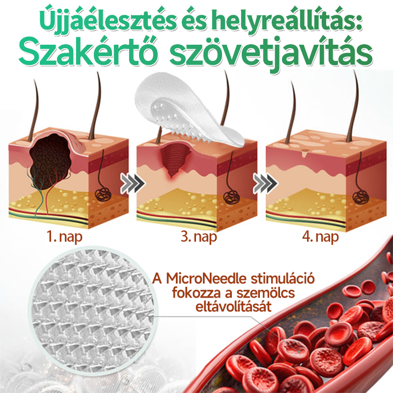 👉𝐗𝐈𝐌𝐎𝐍𝐓𝐇® 𝟐-𝐚𝐳-𝟏-𝐛𝐞𝐧 𝐌𝐢𝐤𝐫𝐨𝐭ű & 𝐇𝐢𝐝𝐫𝐨𝐤𝐨𝐥𝐨𝐢𝐝 𝐓𝐚𝐩𝐚𝐬𝐳 🇭🇺|👩🧒Kiemelkedő Anyajegyek, Pattanások, Lapos Szemölcsök & Bőrkinövések Eltávolítója | Ráncok, Hegek & Bőrhibák Javítása | Láthatatlan Csillag Pattanástapasz Arcra & Testre | 144 db