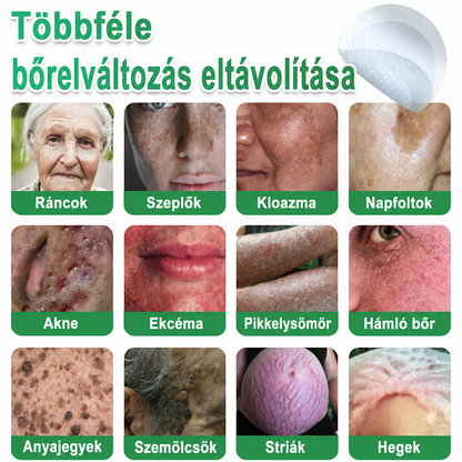 👉𝐗𝐈𝐌𝐎𝐍𝐓𝐇® 𝟐-𝐚𝐳-𝟏-𝐛𝐞𝐧 𝐌𝐢𝐤𝐫𝐨𝐭ű & 𝐇𝐢𝐝𝐫𝐨𝐤𝐨𝐥𝐨𝐢𝐝 𝐓𝐚𝐩𝐚𝐬𝐳 🇭🇺|👩🧒Kiemelkedő Anyajegyek, Pattanások, Lapos Szemölcsök & Bőrkinövések Eltávolítója | Ráncok, Hegek & Bőrhibák Javítása | Láthatatlan Csillag Pattanástapasz Arcra & Testre | 144 db