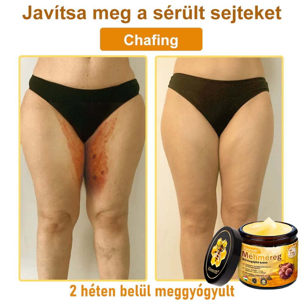 🏆🐝 𝑿𝑰𝑴𝑶𝐍𝐓𝐇® 𝐌é𝐡𝐦é𝒓𝒆𝒈 𝑩ő𝒓𝒓𝒆𝒈𝐞𝐧𝐞𝐫á𝐥ó 𝐊𝐫é𝒎 🔥 Magyar fejlesztés, magyarországi gyártás és szállítás