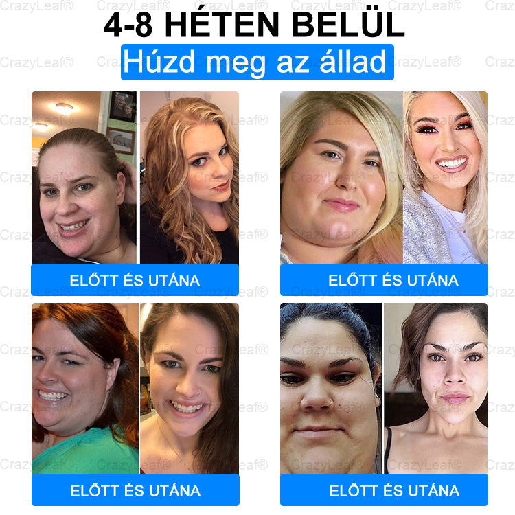 🔥 Utolsó 4 doboz! Extra 50% kedvezmény! Ne hagyja ki – ilyen ajánlat nem lesz többé! 💥