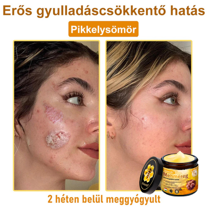🏆🐝 𝑿𝑰𝑴𝑶𝐍𝐓𝐇® 𝐌é𝐡𝐦é𝒓𝒆𝒈 𝑩ő𝒓𝒓𝒆𝒈𝐞𝐧𝐞𝐫á𝐥ó 𝐊𝐫é𝒎 🔥 Magyar fejlesztés, magyarországi gyártás és szállítás
