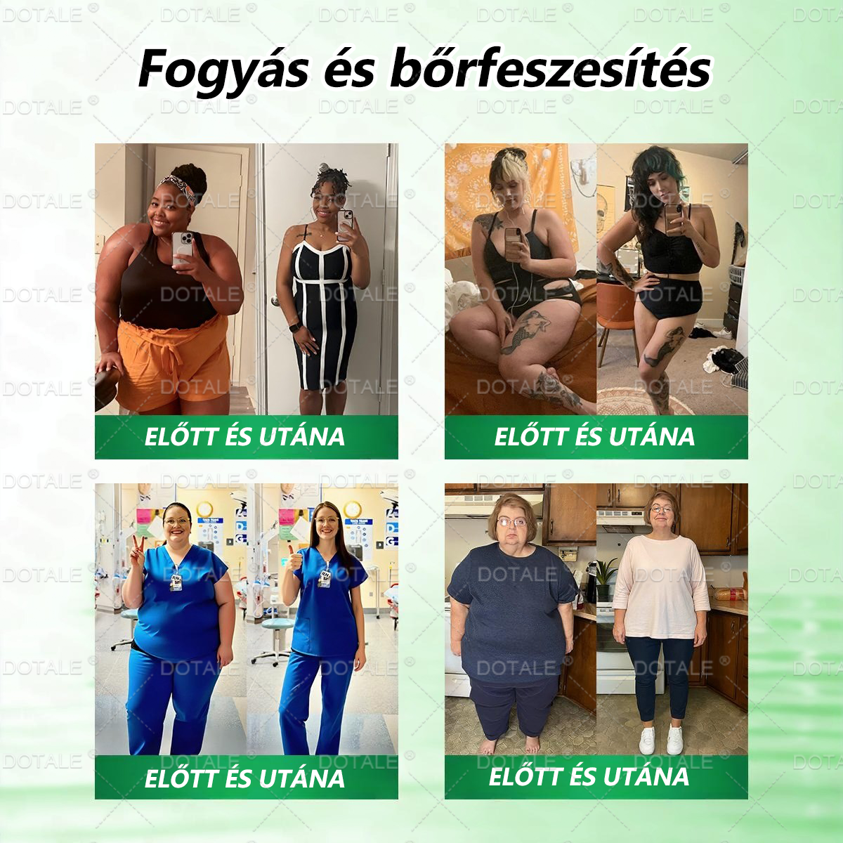 𝑫𝑶𝖳𝖠𝐋𝐄® 𝑴𝒆𝐭𝐚𝐛𝐨𝐥𝐢𝐤𝐮𝐬 𝑵𝒂𝐧𝐨 𝑴𝒊𝒌𝒓𝐨𝐭ú𝐬 𝑇𝑎𝒑𝐚𝐬𝐳🎉 (Csak naponta egyszer használható, látható eredmények 7 napon belül!) ✅ Berenil + Moringa formuláció, ideális tömegtúlzsúlláshoz, bőrhiányossághoz, cukorbetegséghez, apnához és ízületi problémákhoz 💥💥