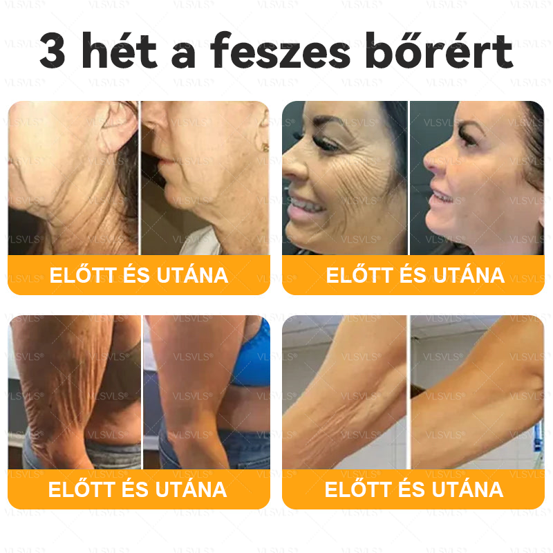 💟🏡✨ Magyarországon készült és innen szállítjuk 🌟  𝐕𝐋𝐒𝑉𝐿𝑆® Méh𝐦é𝐫𝐞𝐠 Bőrhely𝐫𝐞á𝐥𝐥í𝐭ó Krém 🔥 UTOLSÓ NAP – 80% KEDVEZMÉNY