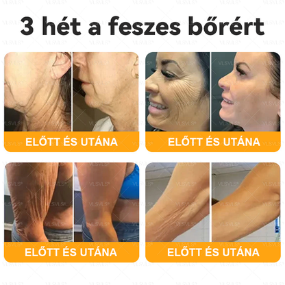 💟🏡✨ Magyarországon készült és innen szállítjuk 🌟  𝐕𝐋𝐒𝑉𝐿𝑆® Méh𝐦é𝐫𝐞𝐠 Bőrhely𝐫𝐞á𝐥𝐥í𝐭ó Krém 🔥 UTOLSÓ NAP – 80% KEDVEZMÉNY