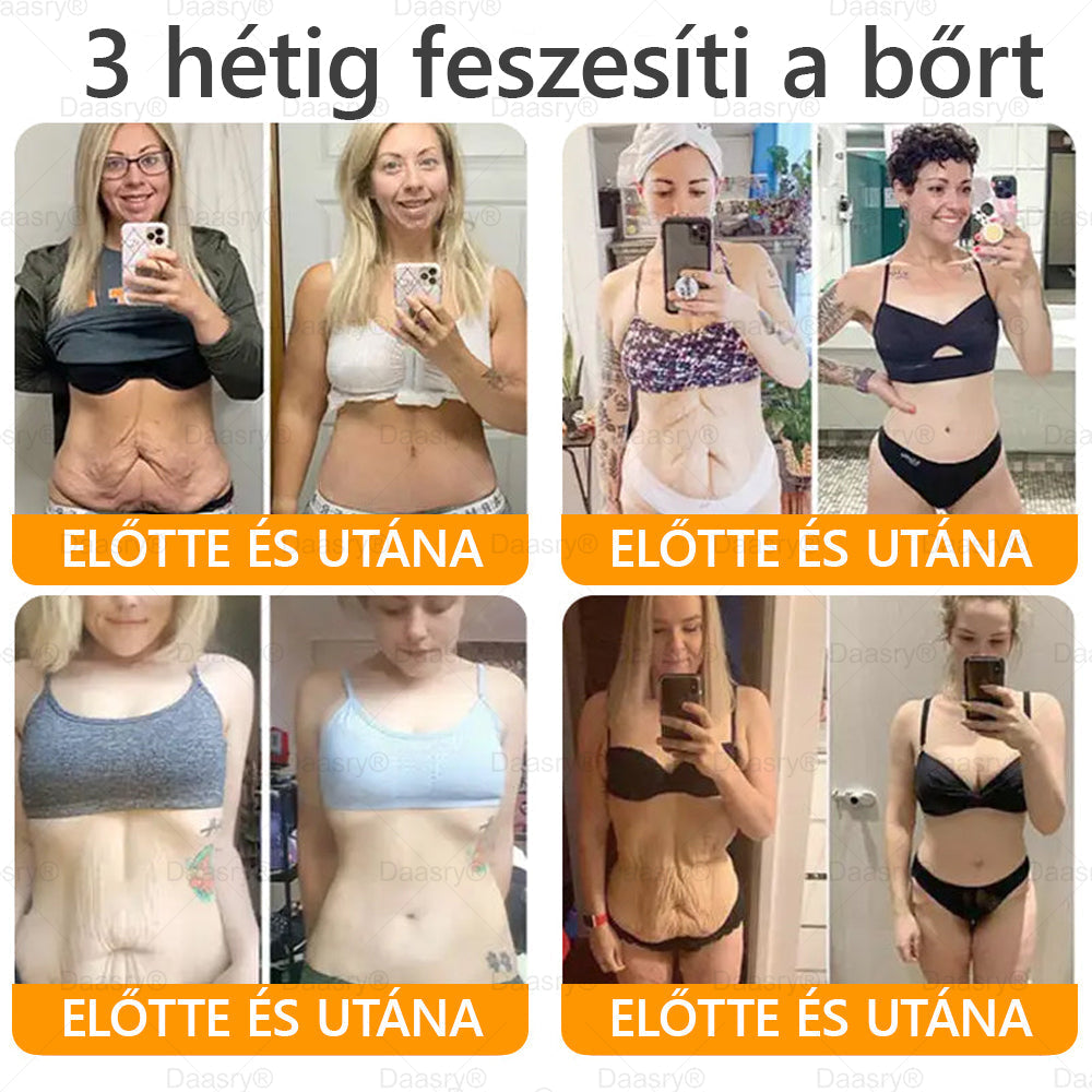 𝐃𝐚𝐚𝐬𝐫𝐲® 𝐌é𝐡𝐦é𝐫𝐞𝐠 𝐊𝐞𝐳𝐞𝐥ő 𝐊𝐫é𝐦, 𝐦é𝐡𝐦é𝐫𝐞𝐠 𝐩𝐞𝐩𝐭𝐢𝐝𝐞𝐤𝐤𝐞𝐥, 𝐛𝐨𝐭𝐮𝐥𝐢𝐧𝐮𝐦 𝐭𝐨𝐱𝐢𝐧𝐧𝐚𝐥, 𝐡𝐢𝐚𝐥𝐮𝐫𝐨𝐧𝐬𝐚𝐯𝐯𝐚𝐥 é𝐬 𝐤𝐨𝐥𝐥𝐚𝐠é𝐧𝐧𝐞𝐥💧. 𝐇𝐚𝐭é𝐤𝐨𝐧𝐲𝐚𝐧 𝐤ü𝐳𝐝 𝐚 𝐫á𝐧𝐜𝐨𝐤, 𝐟𝐢𝐧𝐨𝐦 𝐯𝐨𝐧𝐚𝐥𝐚𝐤, 𝐦𝐞𝐠𝐞𝐫𝐞𝐬𝐳𝐤𝐞𝐝é𝐬, 𝐭𝐞𝐫𝐡𝐞𝐬𝐬é𝐠𝐢 𝐜𝐬í𝐤𝐨𝐤 é𝐬 𝐬ö𝐭é𝐭 𝐟𝐨𝐥𝐭𝐨𝐤 𝐞𝐥𝐥𝐞𝐧 — 𝐟𝐞𝐬𝐳𝐞𝐬í𝐭é𝐬, 𝐞𝐦𝐞𝐥é𝐬 é𝐬 𝐤𝐢𝐞𝐦𝐞𝐥𝐤𝐞𝐝ő 𝐞𝐫𝐞𝐝𝐦é𝐧𝐲𝐞𝐤!