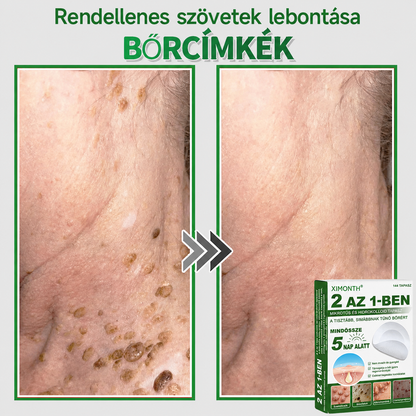 👉𝐗𝐈𝐌𝐎𝐍𝐓𝐇® 𝟐-𝐚𝐳-𝟏-𝐛𝐞𝐧 𝐌𝐢𝐤𝐫𝐨𝐭ű & 𝐇𝐢𝐝𝐫𝐨𝐤𝐨𝐥𝐨𝐢𝐝 𝐓𝐚𝐩𝐚𝐬𝐳 🇭🇺|👩🧒Kiemelkedő Anyajegyek, Pattanások, Lapos Szemölcsök & Bőrkinövések Eltávolítója | Ráncok, Hegek & Bőrhibák Javítása | Láthatatlan Csillag Pattanástapasz Arcra & Testre | 144 db