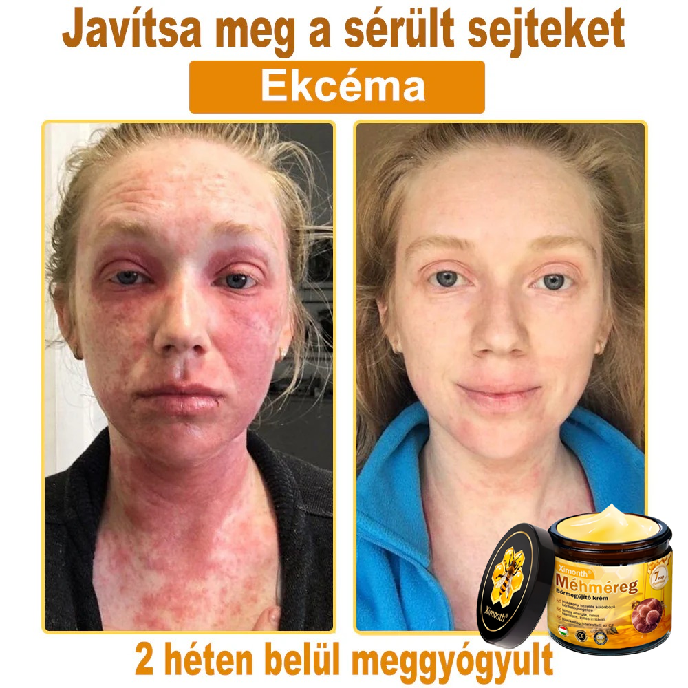 🏆🐝 𝑿𝑰𝑴𝑶𝐍𝐓𝐇® 𝐌é𝐡𝐦é𝒓𝒆𝒈 𝑩ő𝒓𝒓𝒆𝒈𝐞𝐧𝐞𝐫á𝐥ó 𝐊𝐫é𝒎 🔥 Magyar fejlesztés, magyarországi gyártás és szállítás
