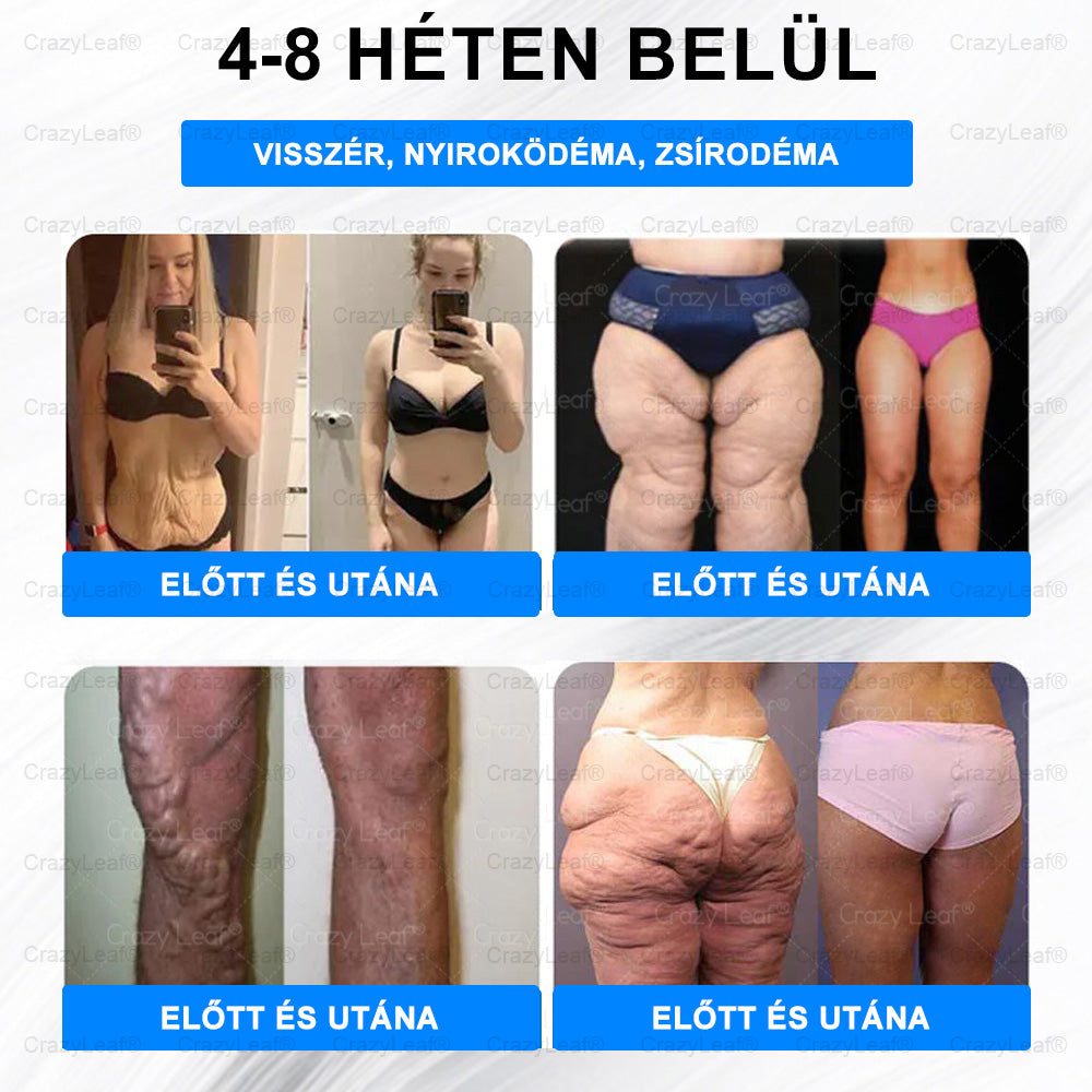 🔥 Utolsó 4 doboz! Extra 50% kedvezmény! Ne hagyja ki – ilyen ajánlat nem lesz többé! 💥