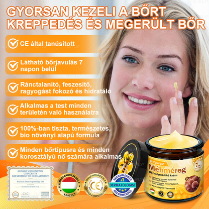 💟🏡✨ Magyarországon készült és innen szállítjuk 🌟  𝐕𝐋𝐒𝑉𝐿𝑆® Méh𝐦é𝐫𝐞𝐠 Bőrhely𝐫𝐞á𝐥𝐥í𝐭ó Krém 🔥 UTOLSÓ NAP – 80% KEDVEZMÉNY