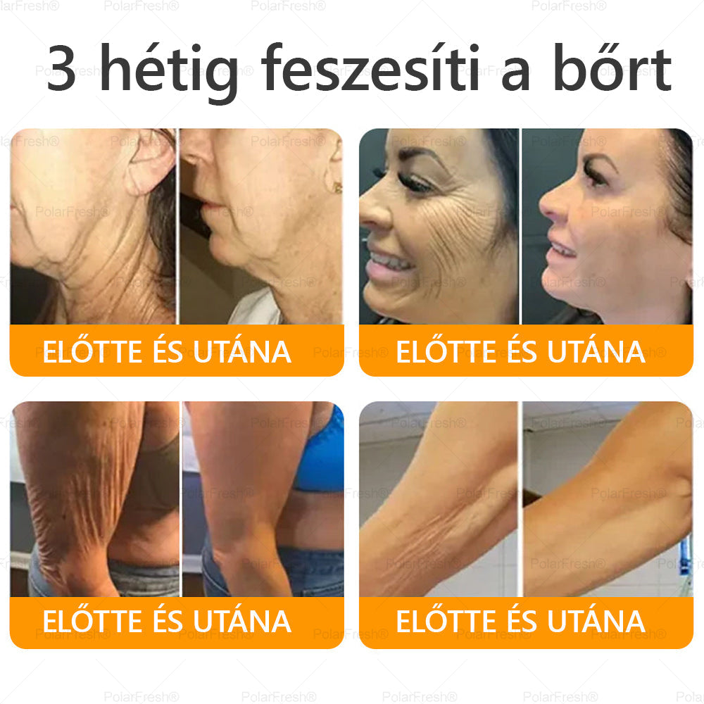 𝐃𝐚𝐚𝐬𝐫𝐲® 𝐌é𝐡𝐦é𝐫𝐞𝐠 𝐊𝐞𝐳𝐞𝐥ő 𝐊𝐫é𝐦, 𝐦é𝐡𝐦é𝐫𝐞𝐠 𝐩𝐞𝐩𝐭𝐢𝐝𝐞𝐤𝐤𝐞𝐥, 𝐛𝐨𝐭𝐮𝐥𝐢𝐧𝐮𝐦 𝐭𝐨𝐱𝐢𝐧𝐧𝐚𝐥, 𝐡𝐢𝐚𝐥𝐮𝐫𝐨𝐧𝐬𝐚𝐯𝐯𝐚𝐥 é𝐬 𝐤𝐨𝐥𝐥𝐚𝐠é𝐧𝐧𝐞𝐥💧. 𝐇𝐚𝐭é𝐤𝐨𝐧𝐲𝐚𝐧 𝐤ü𝐳𝐝 𝐚 𝐫á𝐧𝐜𝐨𝐤, 𝐟𝐢𝐧𝐨𝐦 𝐯𝐨𝐧𝐚𝐥𝐚𝐤, 𝐦𝐞𝐠𝐞𝐫𝐞𝐬𝐳𝐤𝐞𝐝é𝐬, 𝐭𝐞𝐫𝐡𝐞𝐬𝐬é𝐠𝐢 𝐜𝐬í𝐤𝐨𝐤 é𝐬 𝐬ö𝐭é𝐭 𝐟𝐨𝐥𝐭𝐨𝐤 𝐞𝐥𝐥𝐞𝐧 — 𝐟𝐞𝐬𝐳𝐞𝐬í𝐭é𝐬, 𝐞𝐦𝐞𝐥é𝐬 é𝐬 𝐤𝐢𝐞𝐦𝐞𝐥𝐤𝐞𝐝ő 𝐞𝐫𝐞𝐝𝐦é𝐧𝐲𝐞𝐤!