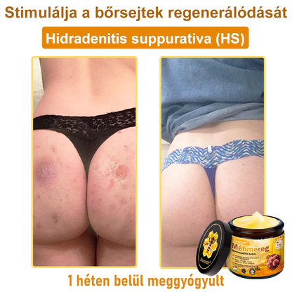 🏆🐝 𝑿𝑰𝑴𝑶𝐍𝐓𝐇® 𝐌é𝐡𝐦é𝒓𝒆𝒈 𝑩ő𝒓𝒓𝒆𝒈𝐞𝐧𝐞𝐫á𝐥ó 𝐊𝐫é𝒎 🔥 Magyar fejlesztés, magyarországi gyártás és szállítás