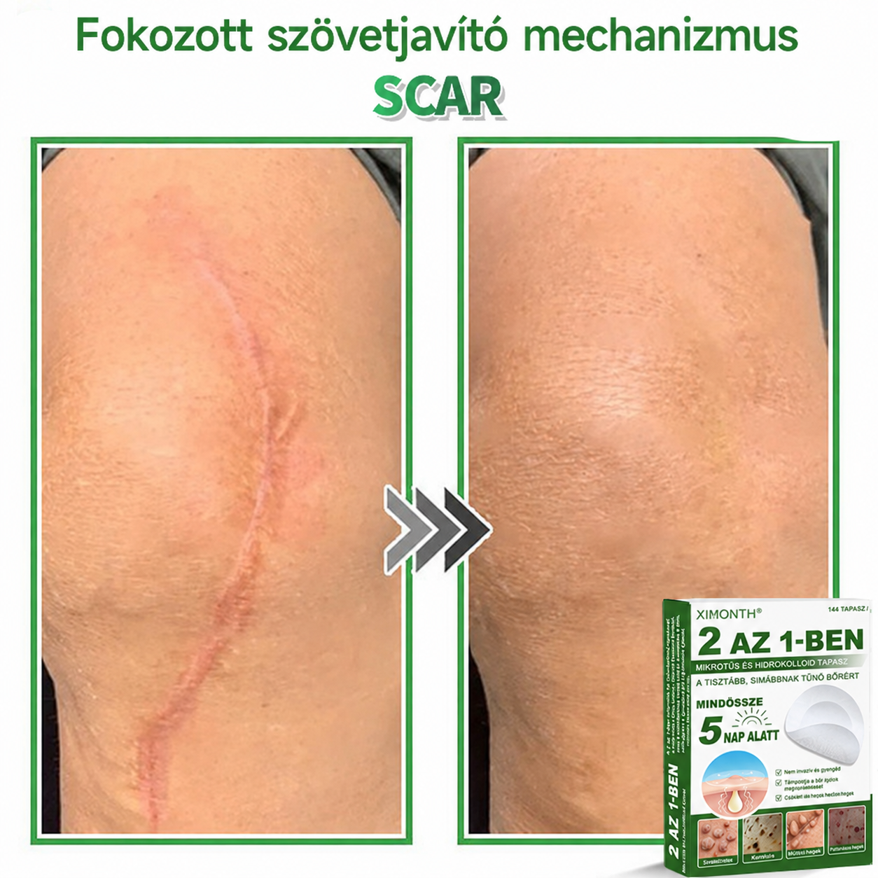 👉𝐗𝐈𝐌𝐎𝐍𝐓𝐇® 𝟐-𝐚𝐳-𝟏-𝐛𝐞𝐧 𝐌𝐢𝐤𝐫𝐨𝐭ű & 𝐇𝐢𝐝𝐫𝐨𝐤𝐨𝐥𝐨𝐢𝐝 𝐓𝐚𝐩𝐚𝐬𝐳 🇭🇺|👩🧒Kiemelkedő Anyajegyek, Pattanások, Lapos Szemölcsök & Bőrkinövések Eltávolítója | Ráncok, Hegek & Bőrhibák Javítása | Láthatatlan Csillag Pattanástapasz Arcra & Testre | 144 db