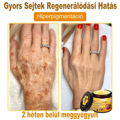🏆🐝 𝑿𝑰𝑴𝑶𝐍𝐓𝐇® 𝐌é𝐡𝐦é𝒓𝒆𝒈 𝑩ő𝒓𝒓𝒆𝒈𝐞𝐧𝐞𝐫á𝐥ó 𝐊𝐫é𝒎 🔥 Magyar fejlesztés, magyarországi gyártás és szállítás